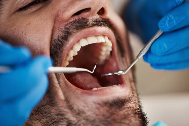 Best Emergency Dental Care for Abscessed Tooth in Madison Heights, MI